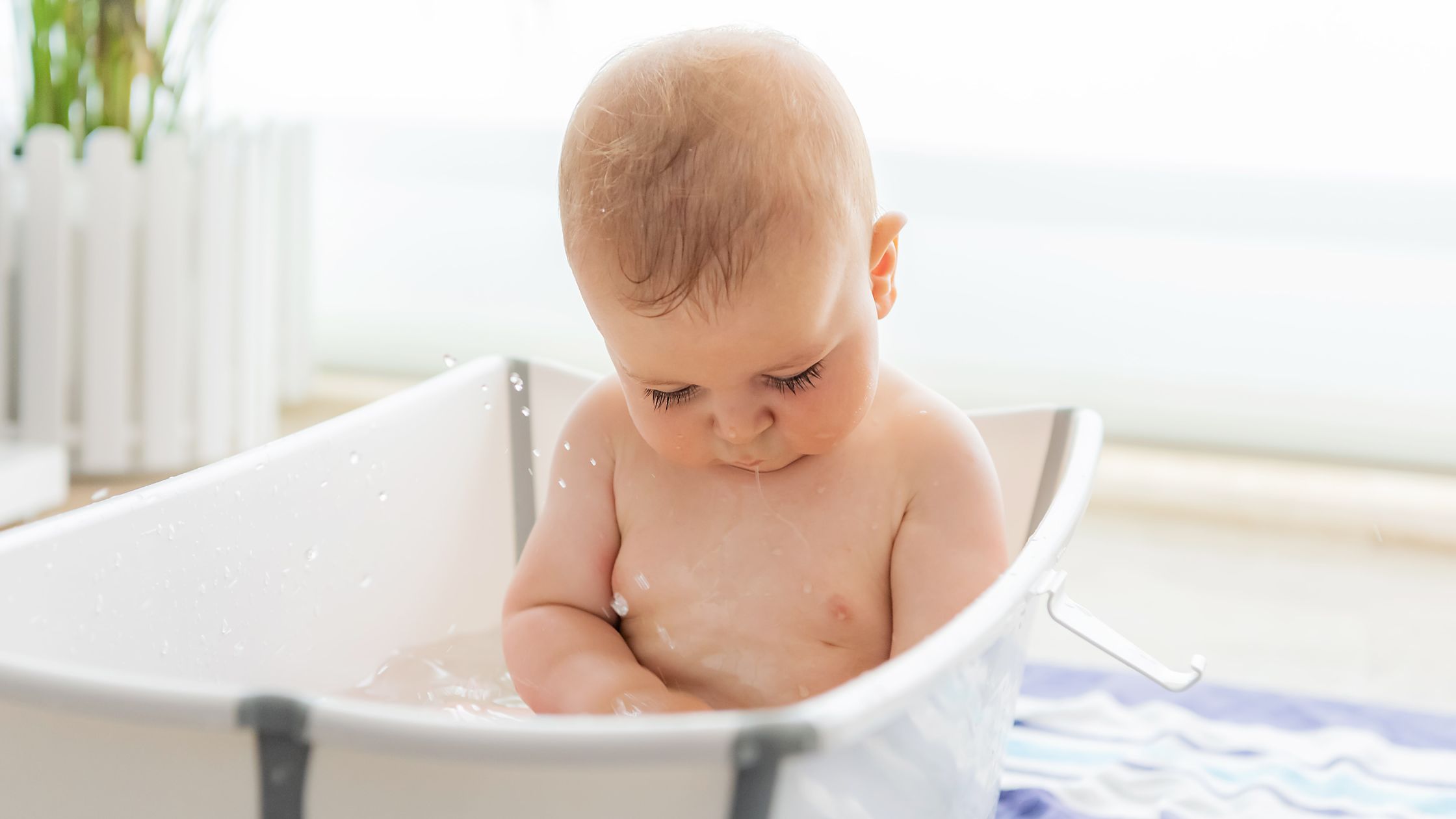 Foto de bebê com sintomas de fimose.